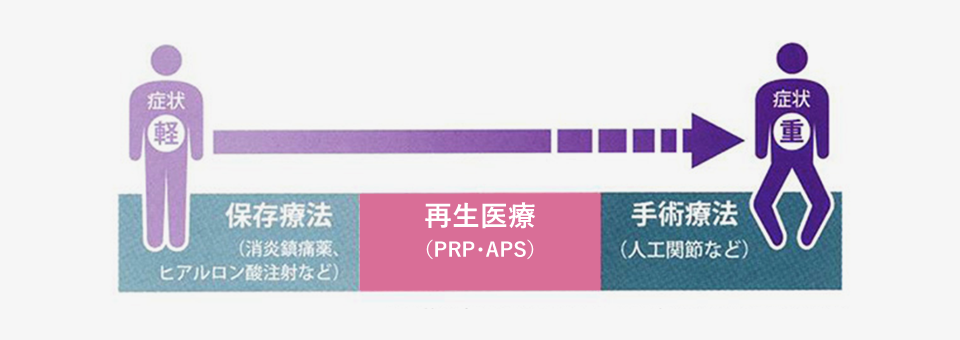 次世代治療　PRP・APS療法