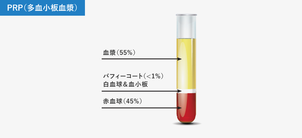 PRP（多血小板血漿）