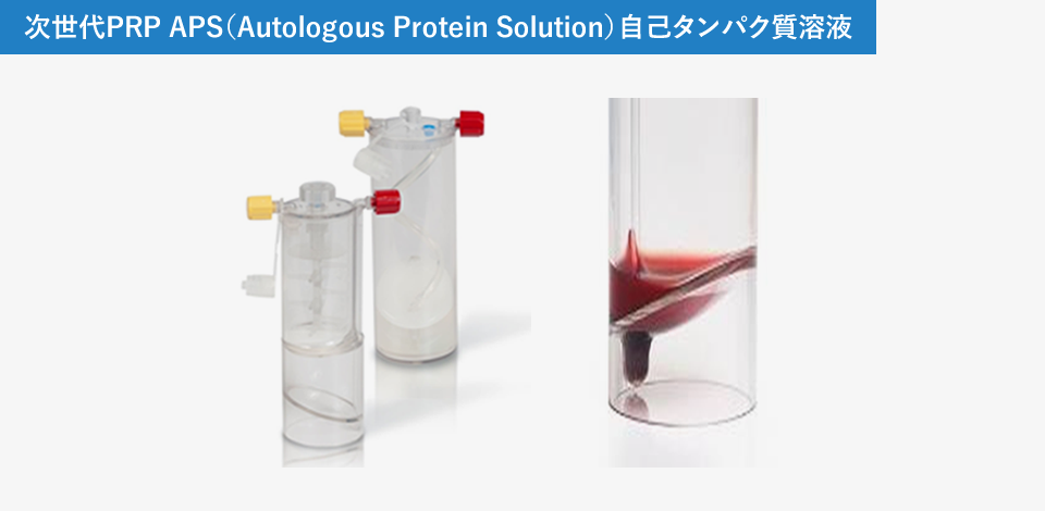次世代PRP APS（Autologous Protein Solution）自己タンパク質溶液