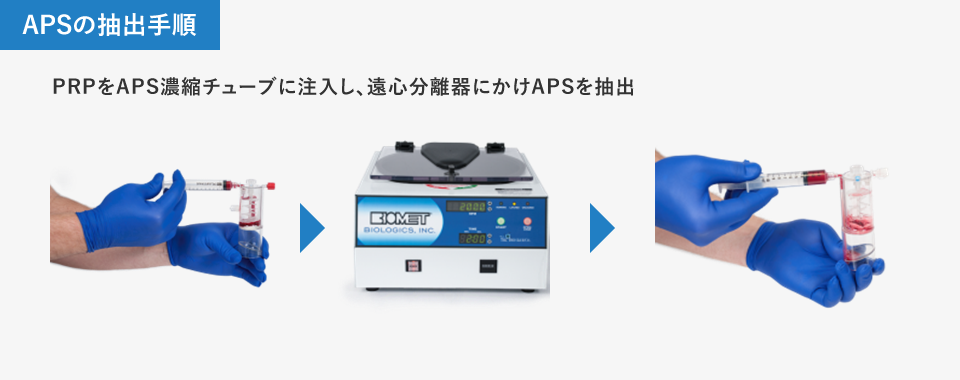 APSの抽出手順